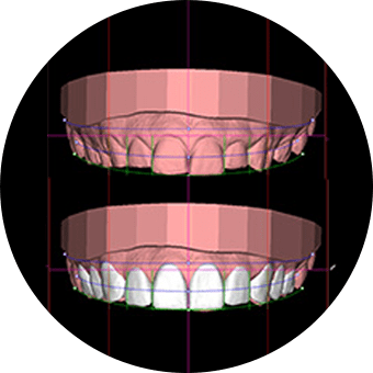 Digital Smile Design