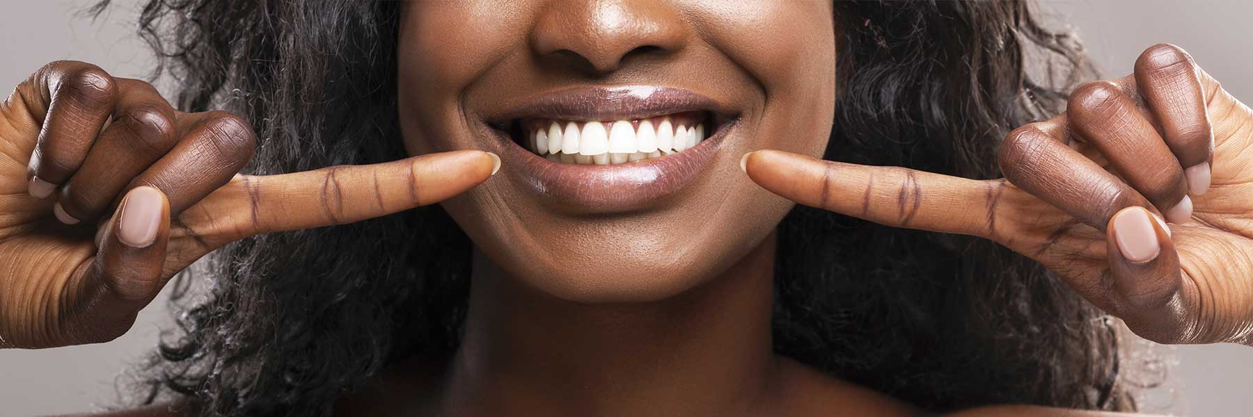 Porcelain Veneers