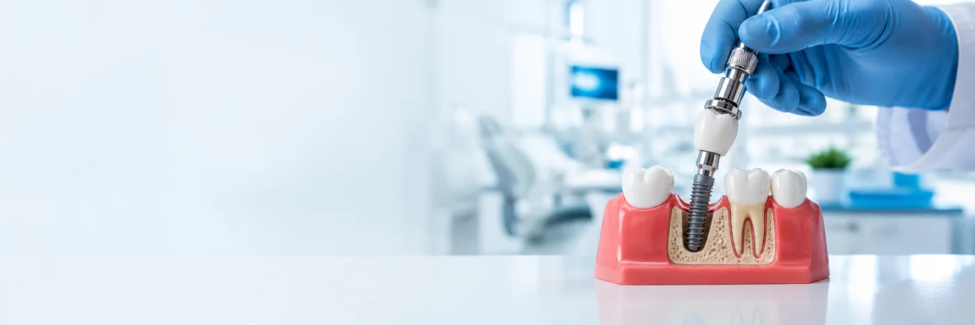 Can Dental Implants Be Removed